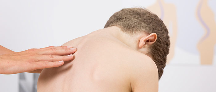 Chiropractic Care in Overland Park For Scoliosis Relief